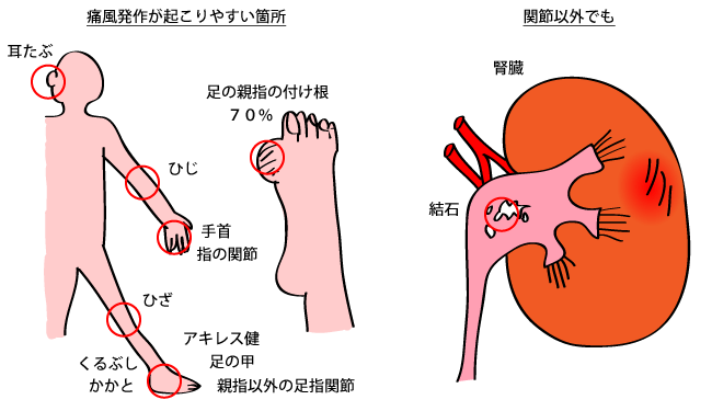 痛み 付け根 足 親指 の 足の指の付け根が痛い!! 痛みの症状と原因は？